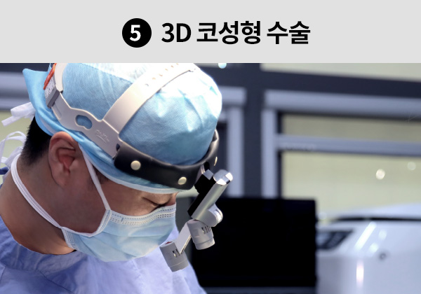 5. 3D 코성형 수술